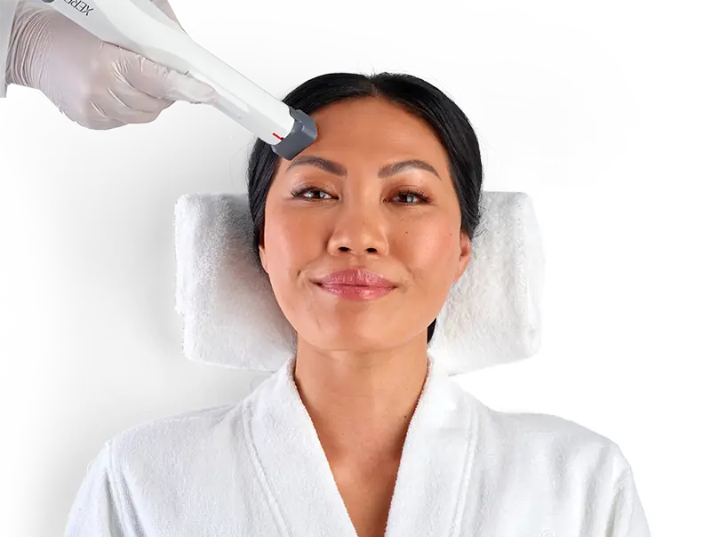 XERF handpiece applied to a client's forehead during a radiofrequency skin-tightening treatment