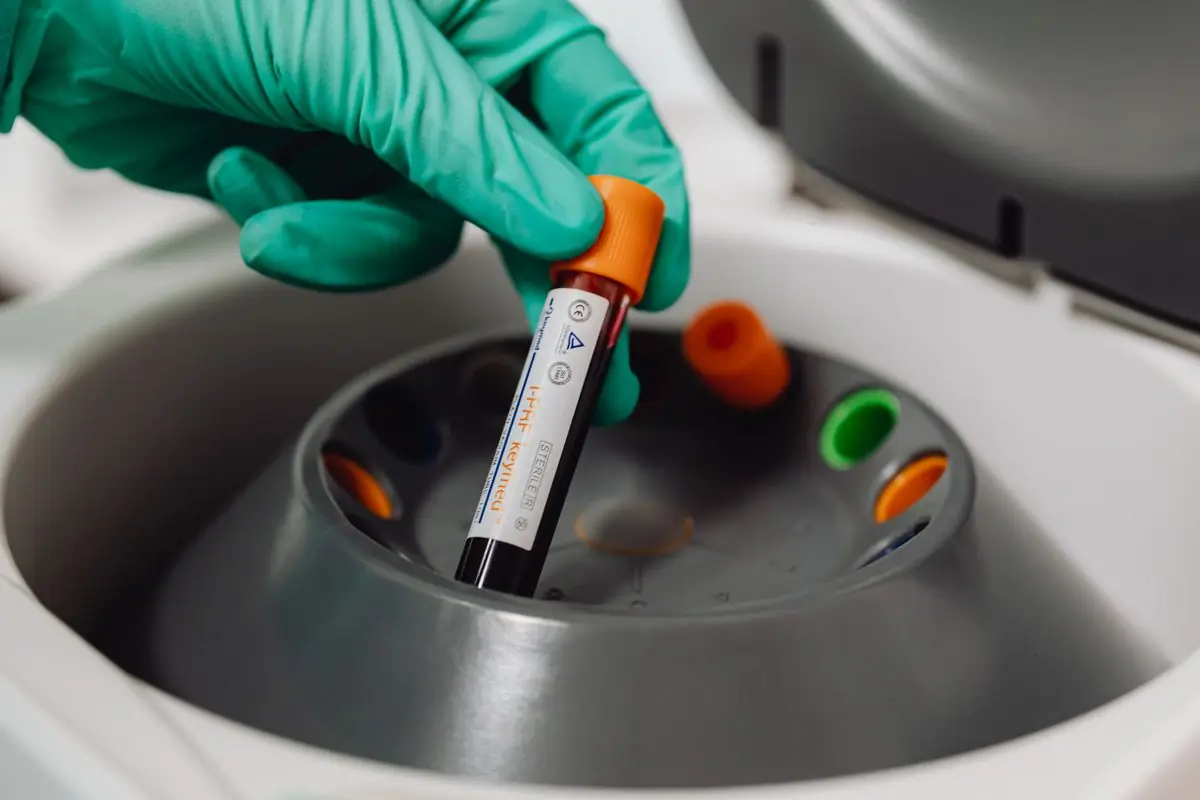 Gloved hand placing a blood sample tube into a centrifuge to prepare platelet-rich plasma