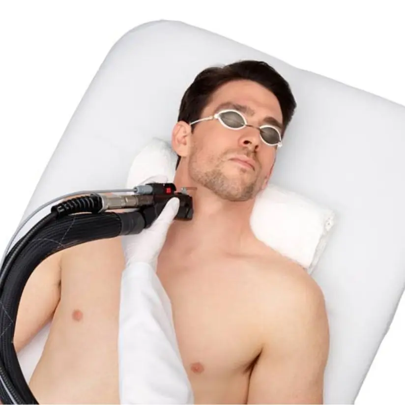 Laser hair removal handpiece treating a client's neck while he wears protective eyewear